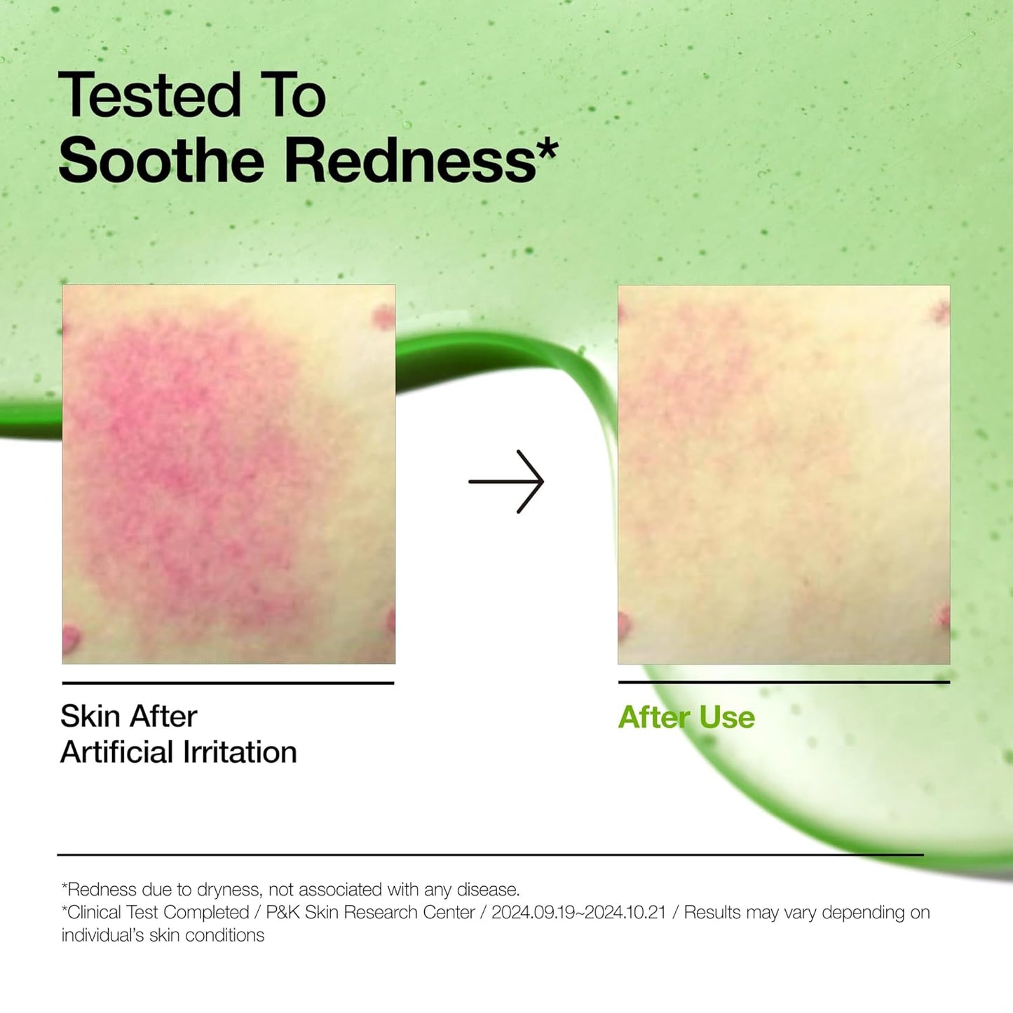 Anua Azelaic Acid 10+ Hyaluron